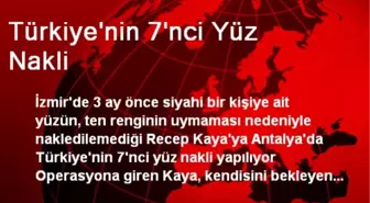 Türkiye'nin 7'nci Yüz Nakli