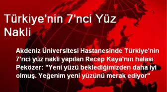 Türkiye'nin 7'nci Yüz Nakli