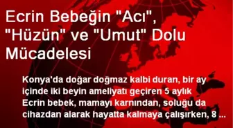 Ecrin Bebeğin 'Acı', 'Hüzün' ve 'Umut' Dolu Mücadelesi