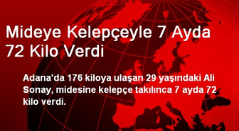 Adana'da Mideye Kelepçeyle 7 Ayda 72 Kilo Verdi