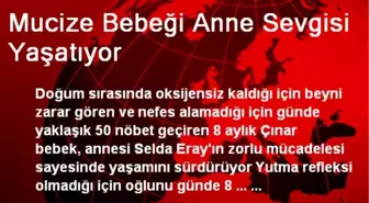 Mucize Bebeği Anne Sevgisi Yaşatıyor