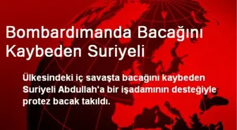 Bombardımanda Bacağını Kaybeden Suriyeliye Protez Takıldı