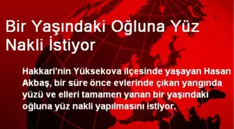 Bir Yaşındaki Oğluna Yüz Nakli İstiyor