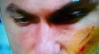 Galatasaray Çakmağı Atana Hesap Soracak!