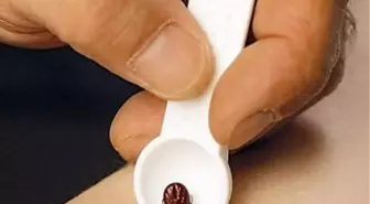 Kenenin Isırdığı Yaşlı Adam Kkka Şüphesiyle Tedavi Altına Alındı