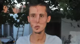 Validen, Yüz Nakli Olan Gence İş ve Eş Sözü