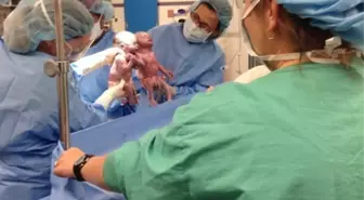İkiz Bebekler El Ele Doğdu