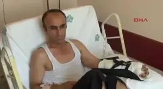 Pres Makinasında Bileğinden Kopan Sol Eli Geri Dikildi