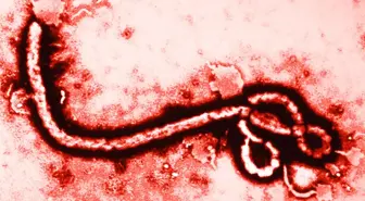 Dünya Sağlık Örgütü: 2015'te Milyonlarca Doz Ebola Aşısı Üretilecek