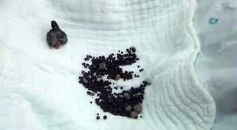Bitlis'te Böbreğinden 794 Adet Taş Çıktı