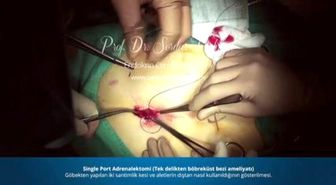 Single Port Adrenalektomi - Prof. Dr. Serdar Tezelman