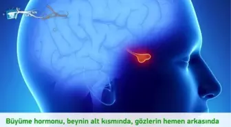 Akromegali