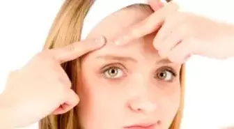 Akne Sorunu Kişiye Göre Değişiyor!