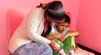 Wilms Tümörü Hastası Küçük Kız Yardım Bekliyor