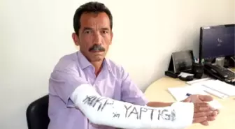 Kırılan Kolundaki Alçıya 'Akp'nin Yaptığı' Diye Yazdı
