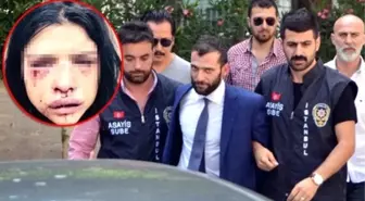 Onur Özbizerdik'in Sevgilisi Konuştu: Bana 'Annem Gibi Öleceksin' Dedi