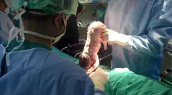 Gevaş'ta İlk Sezaryen Doğum Gerçekleştirildi