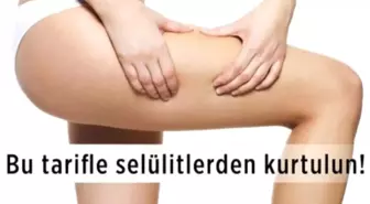 Selülitlerden Kurtulun!