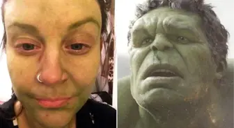 Genç Kadın Bronzlaşayım Derken Hulk'a Döndü!