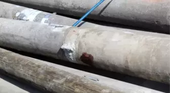 Beton Direğin Altında Kalan Çocuk Ağır Yaralandı