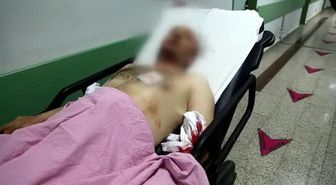 Samsun'da Silahlı Kavga: 3 Yaralı