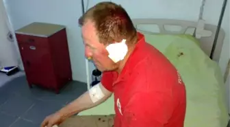 Çobanlar Çiftçiyi Sopayla Dövdü