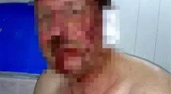 Çobanlar, Koyunlarını Otlattıkları Tarla Sahibini Hastanelik Etti