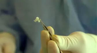Kalp Kası Çalışmayan Çocuk Kök Kücreyle Hayata Tutundu