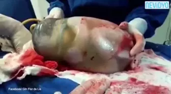 Bebeğin Böyle Doğduğuna İnanamadılar!