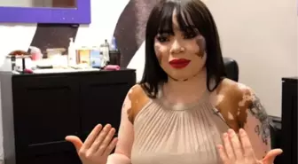 Vitiligo Hastası Kadın Makyaj Sanatçısı Oldu