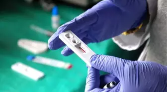 İngiliz Bilim Adamları AIDS'li Hastayı İyileştirdi