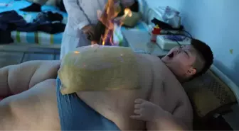 150 Kiloluk Çocuk, Geleneksel Çin Tedavileriyle Zayıflayacak