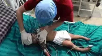 Haleplilerin Yaraları Elbise Parçaları ile Sarılmış