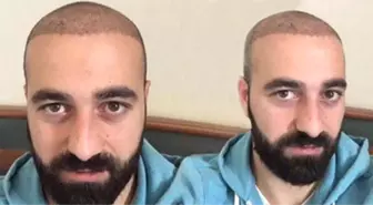 Erzurumspor'da Fahri Tatan, Habersiz Saç Ektirince Takımdan Kovuldu