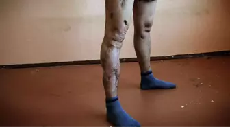Krokodil Adlı Uyuşturucu Tiryakisini Çürüyen Zombiye Dönüştürüyor
