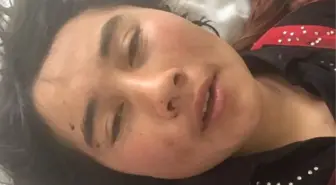 Kocasının Kulaklarını Kestiği Kadın Dehşet Anlarını Anlattı