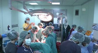 Yapışık Ikizler Tek Karaciğerle Dünyaya Geldi