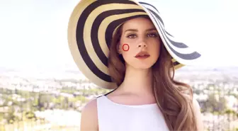 Lana Del Rey'in Yanağındaki Benin Sırrı Ortaya Çıktı