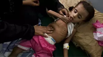 Yemen'de 'Açlık' Tehlikesi