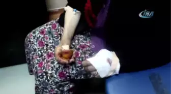 Kurt Köylülere Saldırdı: 4 Yaralı