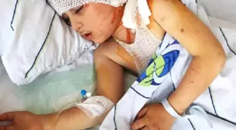 Topunu Almaya Çalışan Minik Eymen'e 6 Sokak Köpeği Saldırdı