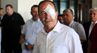 Güncelleme - Edirne Belediye Başkanı Gürkan'a Yapılan Yumruklu Saldırı