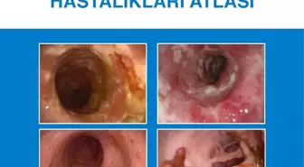 İnflamatuar Bağırsak Hastalıkları Atlası' Kitabı Yayımlandı