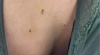 Kına Eğlencesinde Maganda Dehşeti: 10 Yaralı