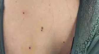 Kına Eğlencesinde Maganda Dehşeti: 10 Yaralı