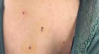 Kına Eğlencesinde Mlaganda Kurşunu: 4 Yaralı