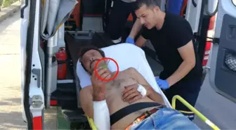 Ambulansa Taşınırken Bile Elindeki Armudu Yemeye Devam Etti!