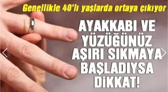 Ayakkabı ve Yüzüğünüz Aşırı Sıkmaya Başladı İse Dikkat..!!