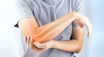 Dünya Osteoporoz Günü Yaklaşırken Uzmanlar Uyarıyor