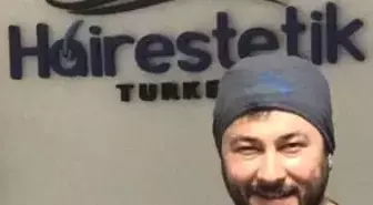 Saç Ekiminde Doğal Görünüm Çok Önemli